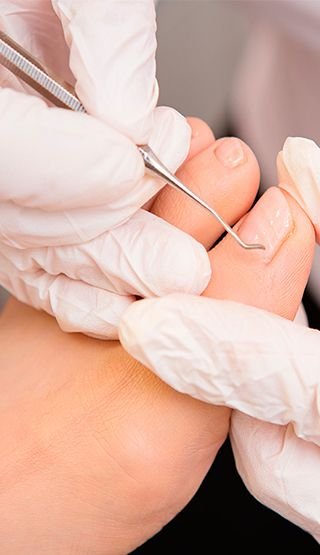 Cuidado profesional de uñas de los pies